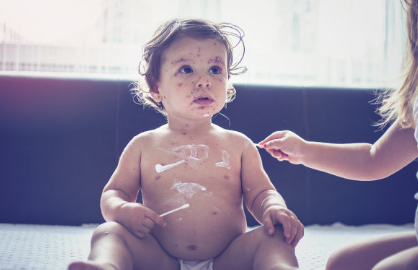 湿疹皮炎春季容易出的疹子家长如何做好预防 宝宝长了疹子该怎么护理